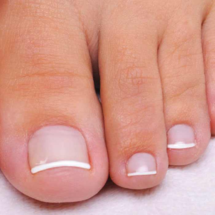 toenail-reconstruction